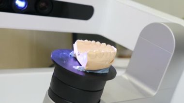 Modern dişçilikte üç boyutlu çene taraması. Diş protezi yenileme. Dişçi, yüksek teknolojili dijital tarama ekipmanlarıyla plastik protezler için 3D model yapıyor. 4k video