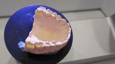 Modern dişçilikte üç boyutlu çene taraması. Diş protezi yenileme. Dişçi, yüksek teknolojili dijital tarama ekipmanlarıyla plastik protezler için 3D model yapıyor. 4k video