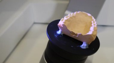 Modern dişçilikte 3D diş taraması. Diş protezi yenileme. Yüksek teknolojili dijital tarama ekipmanlarıyla plastik protezler için 3D model oluşturma süreci. 4k video