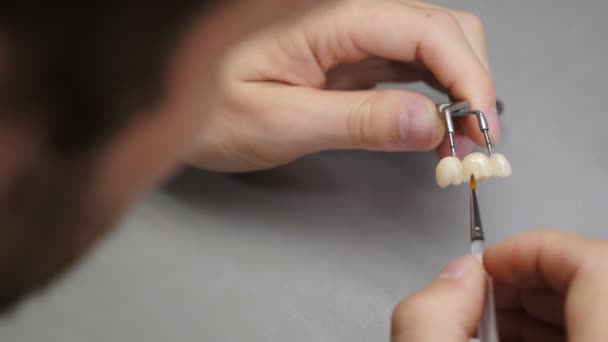 Fogtechnikus, kerámia koronákkal dolgozik a fogászati laborban. Technikus dolgozik új fogsorok, Holding Pincers és alkalmazása Shine a cirkónium. 4 k videó — Stock videók