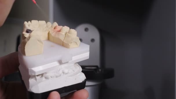 Técnico dental que trabaja con coronas de cerámica en el modelo de mandíbula soplándolo con solución antes de escanear en el moderno laboratorio de clínica dental. Prótesis dental, diente artificial, prótesis. 4 k vídeo — Vídeo de stock