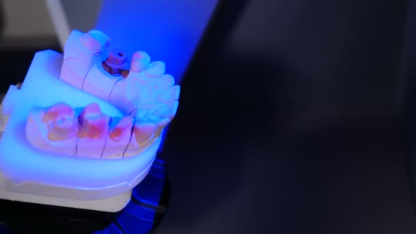 Reconstrucción dental de mandíbula con escáner dental 3D. Laboratorio de clínica dental moderna. Escáner 3D dental de alta tecnología con modelo de mandíbula de yeso. Se está analizando el moho dental. 4 k vídeo — Vídeos de Stock