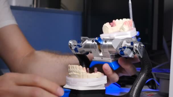 Tandtekniker skanning dentala gjutna modell i 3D-ytan skannrar. Gypsum käken modell med implantat skannas inuti dentala 3D-scanner. Ändra position under processen. 4 k video — Stockvideo