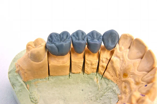 Modello di denti di cera, immagine ravvicinata — Foto Stock