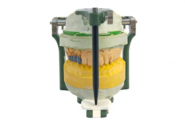Articulador bucal aislado en laboratorio de odontología —  Fotos de Stock