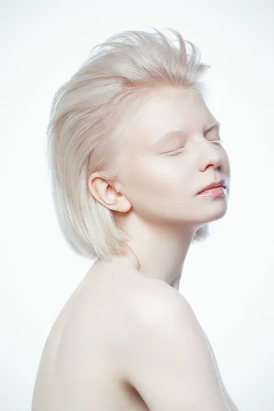 Gyönyörű albínó ypung nő a fehér háttér — Stock Fotó