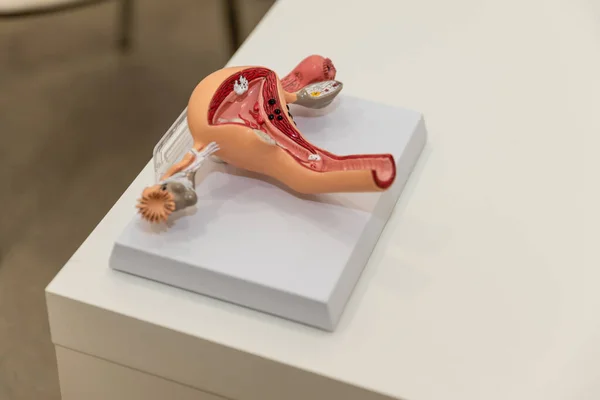 Anatomy of uterus, fallopian tubes and ovaries on example of anatomical model of female genital organ. Concept for study of anatomy of uterus and appendages, illustration of female reproductive system
