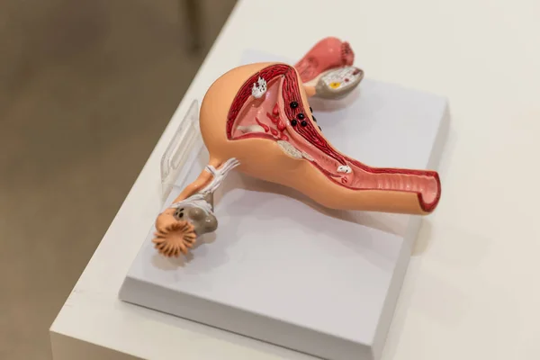 Anatomie Van Baarmoeder Eileiders Eierstokken Bijvoorbeeld Anatomisch Model Van Vrouwelijk Rechtenvrije Stockfoto's