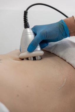 Mükemmel vücut telsizi tedavisi. Spa 'daki kadın. Doktor eli ve kız vücudu. RF kozmetik kaldırma. Göbek derisi.