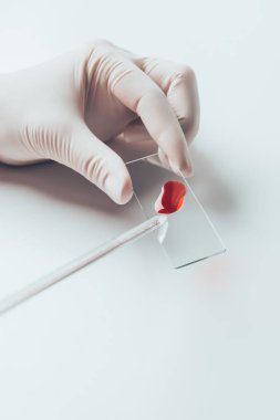 cropped shot of doctor pouring blood from pipette onto blood slide for examination clipart