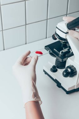 mikroskop muayene için kan örneği koyarak doktor doz kırpılmış