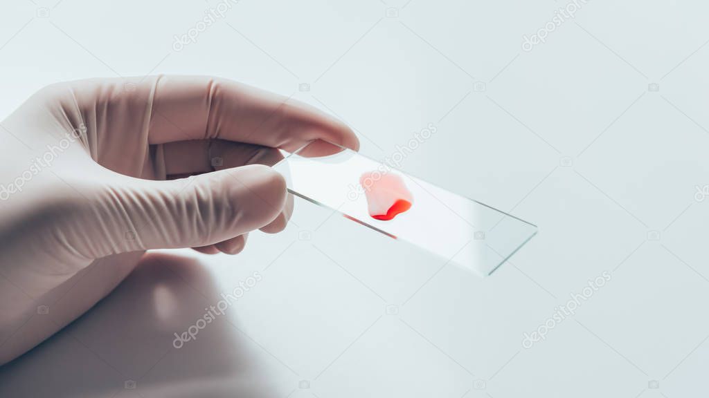 cropped shot of doctor in white glove holding glass slide with blood Sample
