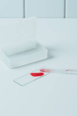 blood sample on glass slide with pipette on white table clipart