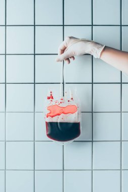 cropped shot of doctor in glove holding plastic bag with blood for transfusion in front of tiled white wall clipart