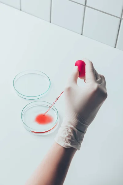 Tiro Cortado Médico Derramando Sangue Placa Petri — Fotos gratuitas
