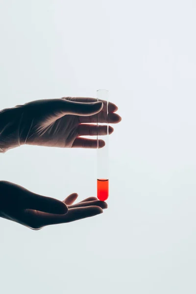 Schnappschuss Von Arzt Handschuhen Mit Glas Reagenzglas Mit Blut Isoliert — Stockfoto