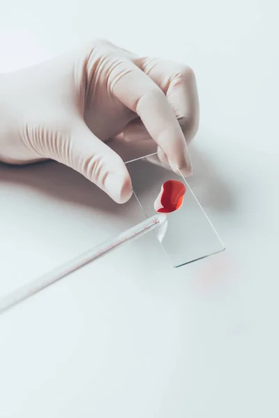 Inyección recortada del médico vertiendo sangre de la pipeta en el portaobjetos de sangre para su examen - foto de stock