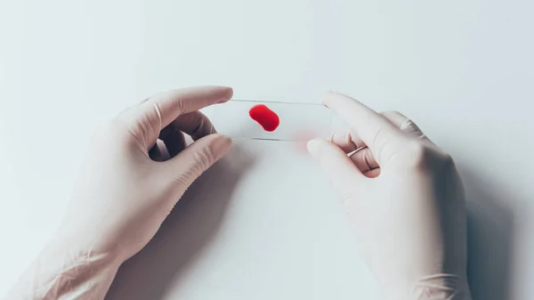 Inyección recortada de médico en guantes blancos sosteniendo diapositiva de vidrio con sangre Muestra sobre mesa blanca - foto de stock