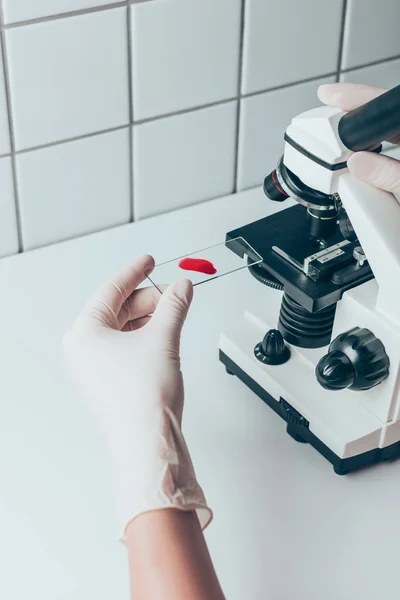 Inyección recortada de médico poniendo la muestra de sangre en el microscopio para su examen - foto de stock