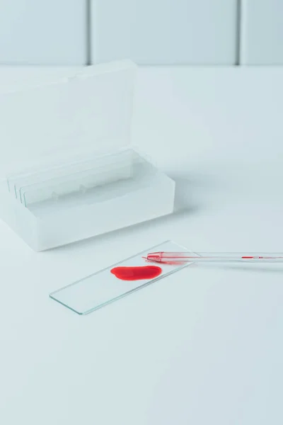 Muestra de sangre en la diapositiva de cristal con pipeta en la mesa blanca - foto de stock