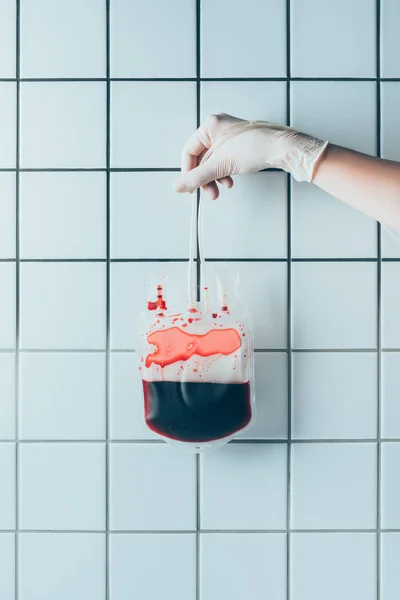 Cliché recadré du médecin dans un gant tenant un sac en plastique avec du sang pour transfusion devant un mur blanc carrelé — Photo de stock