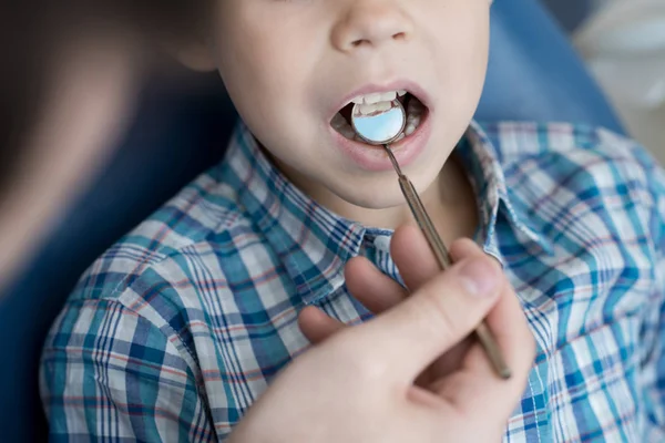 Close Portrait Cute Little Boy Sitting Dental Chair Mouth Open — Stock Photo, Image