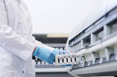 Tüp silindir karıştırıcıiçine kan örnekleri koyan beyaz önlük lü ve steril eldivenli tanınmayan laboratuvar teknisyeninin yakın çekim