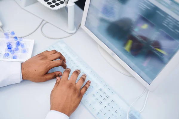 Närbild Oigenkännlig Svart Laboratorie Forskare Sitter Vid Bordet Och Skriva — Stockfoto