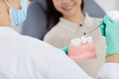 Klinikte hastaya danışırken tanınmayan diş hekiminin diş modelini tutmasının yakın çekimi, fotokopi alanı