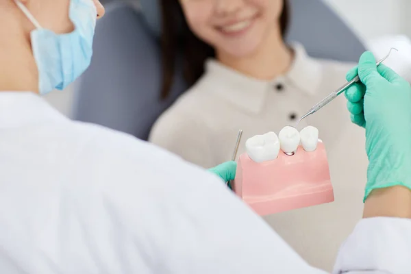 Closeup Dentista Irreconhecível Segurando Modelo Dentário Enquanto Consulta Paciente Clínica — Fotografia de Stock