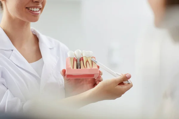 Fechar Sorriso Dentista Feminino Apontando Para Modelo Dentário Enquanto Consulta — Fotografia de Stock