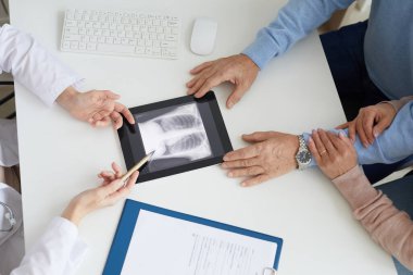 Close up of unrecognizable senior couple listening to female doctor and looking at lung x-ray image during consultation in clinic clipart