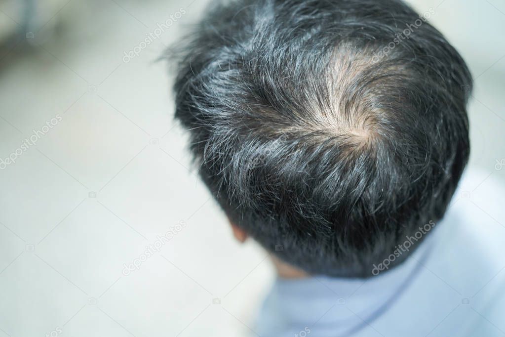 Bold in the middle head and begin no lose hair of mature Asian business smart active office man.