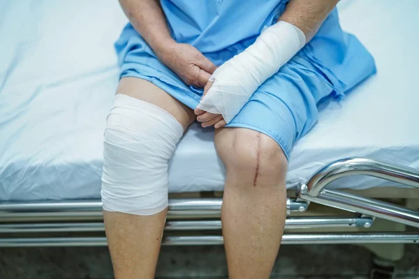 Asiatische Seniorin Oder Ältere Dame Bei Unfall Arm Und Knie — Stockfoto
