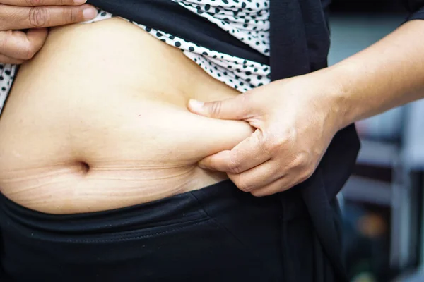 Overweight Asian woman show fat belly at office.