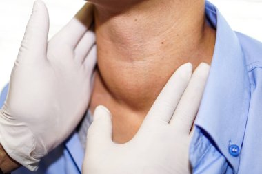 Asyalı kadın kadın hastam var. Boğaz, tiroid bezinin hipertiroidi (aşırı aktif tiroid) anormal genişlemesi: sağlıklı güçlü tıp kavramı