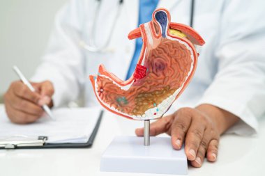 Mide hastalığı, hastanede teşhis ve tedavi için insan anatomisi modeli olan bir doktor..