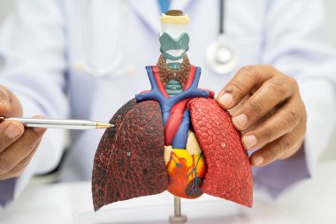 Zatürree, akciğer kanseri, Asyalı doktor hastanede teşhis ve tedavi için insan anatomisi modeli tutuyor.