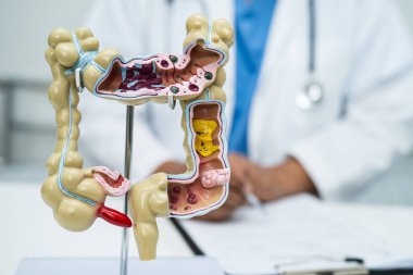 Bağırsak, apandis ve sindirim sistemi, hastanede teşhis ve tedavi için anatomi modelini tutan doktor..