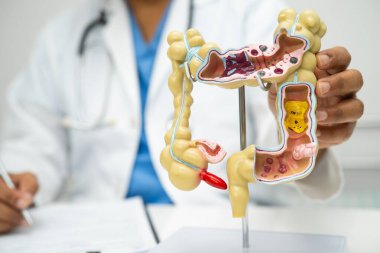 Bağırsak, apandis ve sindirim sistemi, hastanede teşhis ve tedavi için anatomi modelini tutan doktor..