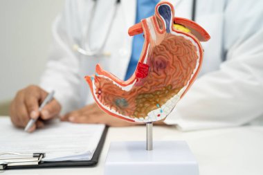 Mide hastalığı, hastanede teşhis ve tedavi için anatomi modeli tutan bir doktor..