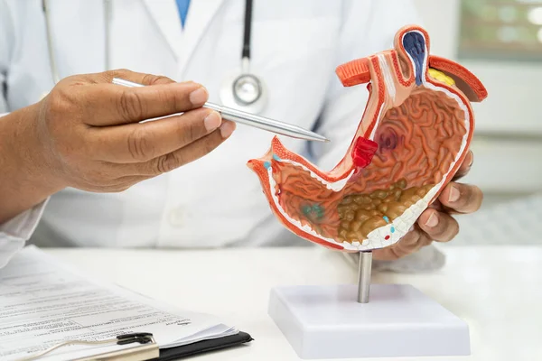 Mide hastalığı, hastanede teşhis ve tedavi için anatomi modeli tutan bir doktor..