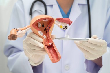 Rahim, hastanede teşhis ve tedavi için insan anatomisi modeli tutan doktor..