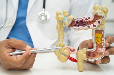 Bağırsak, apandis ve sindirim sistemi, hastanede teşhis ve tedavi için anatomi modelini tutan doktor..