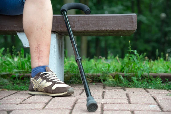 Perna assustada de pessoa com deficiência no banco com uma bengala no Parque — Fotografia de Stock