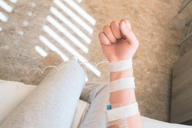 Hasta kemoterapi üstesinden kol