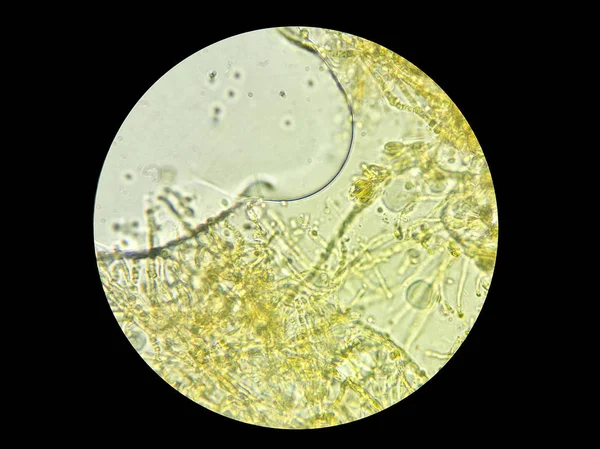Imagen de hongos microscópicos obtenidos a través de un microscopio de luz — Foto de Stock
