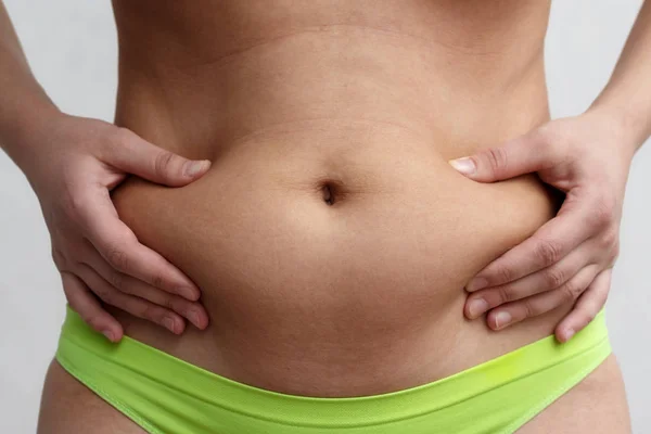 Two Women Hold Hands Fold Excess Belly Fat Gray Background — Stock Photo, Image