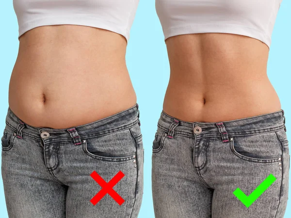 karşılaştırma önce ve sonra. yağlı ve ince göbek. Önden görünüm, mavi arka plan