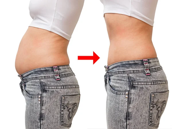 Comparison Fat Thin Belly Side View White Background — Stock Photo, Image